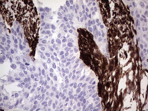 Vimentin Antibody (aa210-466, clone UMAB159)