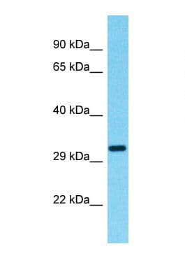 Polyclonal Rabbit anti-Human OR9G9 Antibody (C-Terminus, WB)