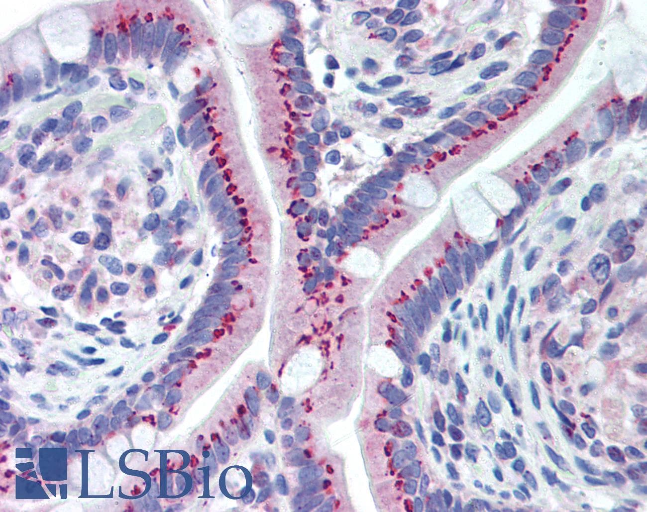 IHC-plus™ Polyclonal Rabbit anti-Human GOLM1 / GP73 / GOLPH2 Antibody (aa67-81, IHC)