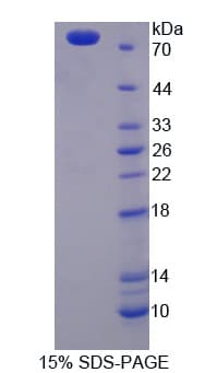 Mouse KRT28 / Keratin 28 Protein (Recombinant His-GST)