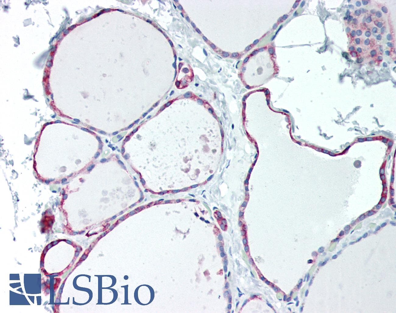 PathPlus™ TPO / Thyroid Peroxidase Antibody