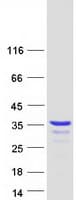 Human WIBG Protein (Recombinant Myc-DDK (Flag))