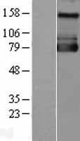 SLC9A1 / NHE1 Protein (Over-Expression Lysate Myc-DDK (Flag))