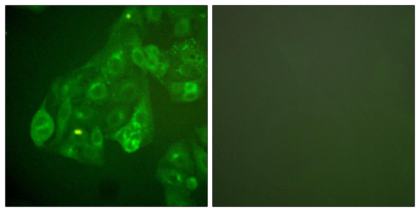 Polyclonal Rabbit anti-Human GJA1 / CX43 / Connexin 43 Antibody (IHC, IF, WB)