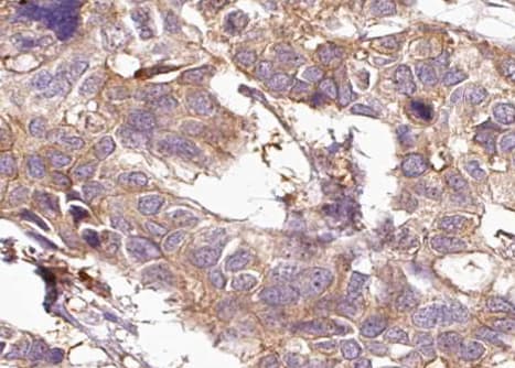 KRT15 / CK15 / Cytokeratin 15 Antibody