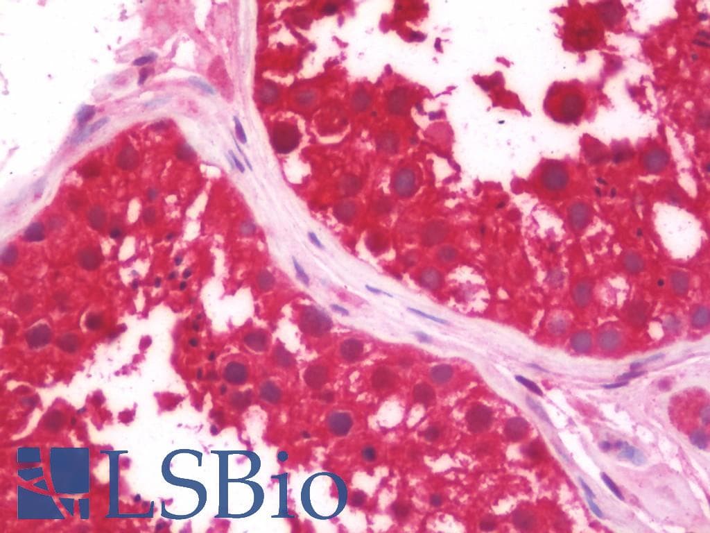 IHC-plus™ CTNS / Cystinosin Antibody (clone 5G6)