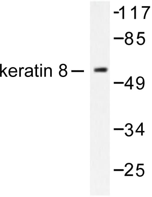 Polyclonal Rabbit anti-Human KRT8 / CK8 / Cytokeratin 8 Antibody (Val463, IHC, IF, WB)