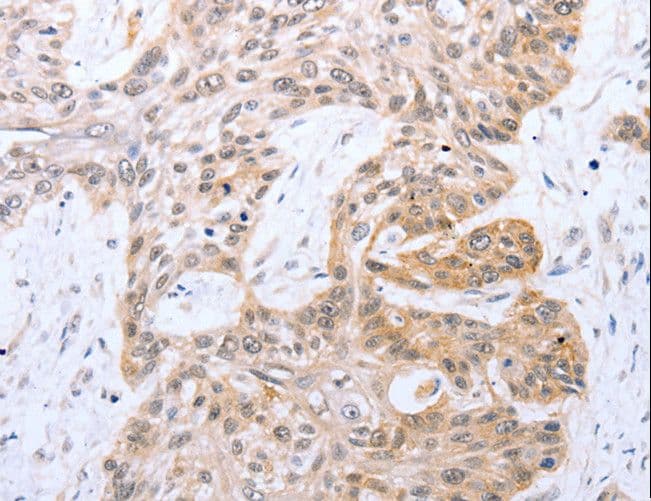 Polyclonal Rabbit anti-Human FADD Antibody (IHC)