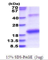 Hepatitis C Virus HCV NS5b Protein (Recombinant His)