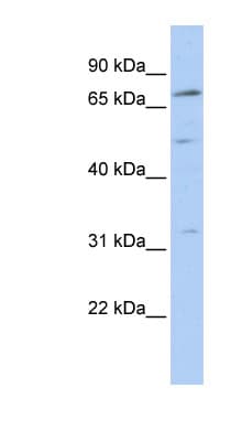 NR6A1 / GCNF Antibody (aa35-84)