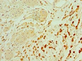 TAC1 Antibody (aa1-129)