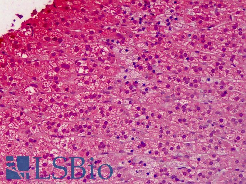 IHC-plus™ GNAI1 / Gi Antibody (clone 2B8-2A5)