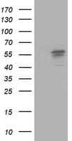 ALDH3A2 Antibody (clone OTI2A7)