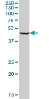 RING1 Antibody (clone 2B3)