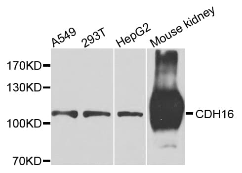 CDH16 / Cadherin 16 Antibody