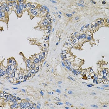 Polyclonal Rabbit anti-Human EIF3H / EIF3S3 Antibody (IHC, IF, WB)