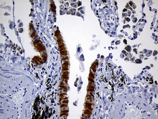 Monoclonal Mouse anti-Human PRDX5 / Peroxiredoxin 5 Antibody (clone OTI4B12, Carrier-free, IHC, WB)