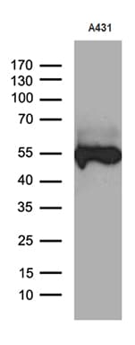 KRT14 / CK14 / Cytokeratin 14 Antibody (aa261-472, clone OTI5F2)