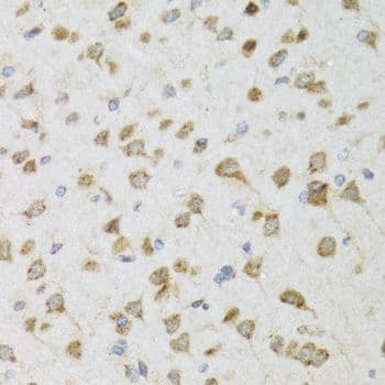 PI3 / Elafin Antibody