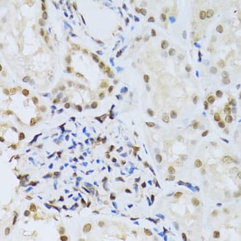 Polyclonal Rabbit anti-Human MAPK3 / ERK1 Antibody (IHC, IF, WB)