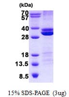 Human RASSF3 Protein (Recombinant His)