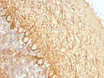 Neurofilament Antibody (clone NR-4)