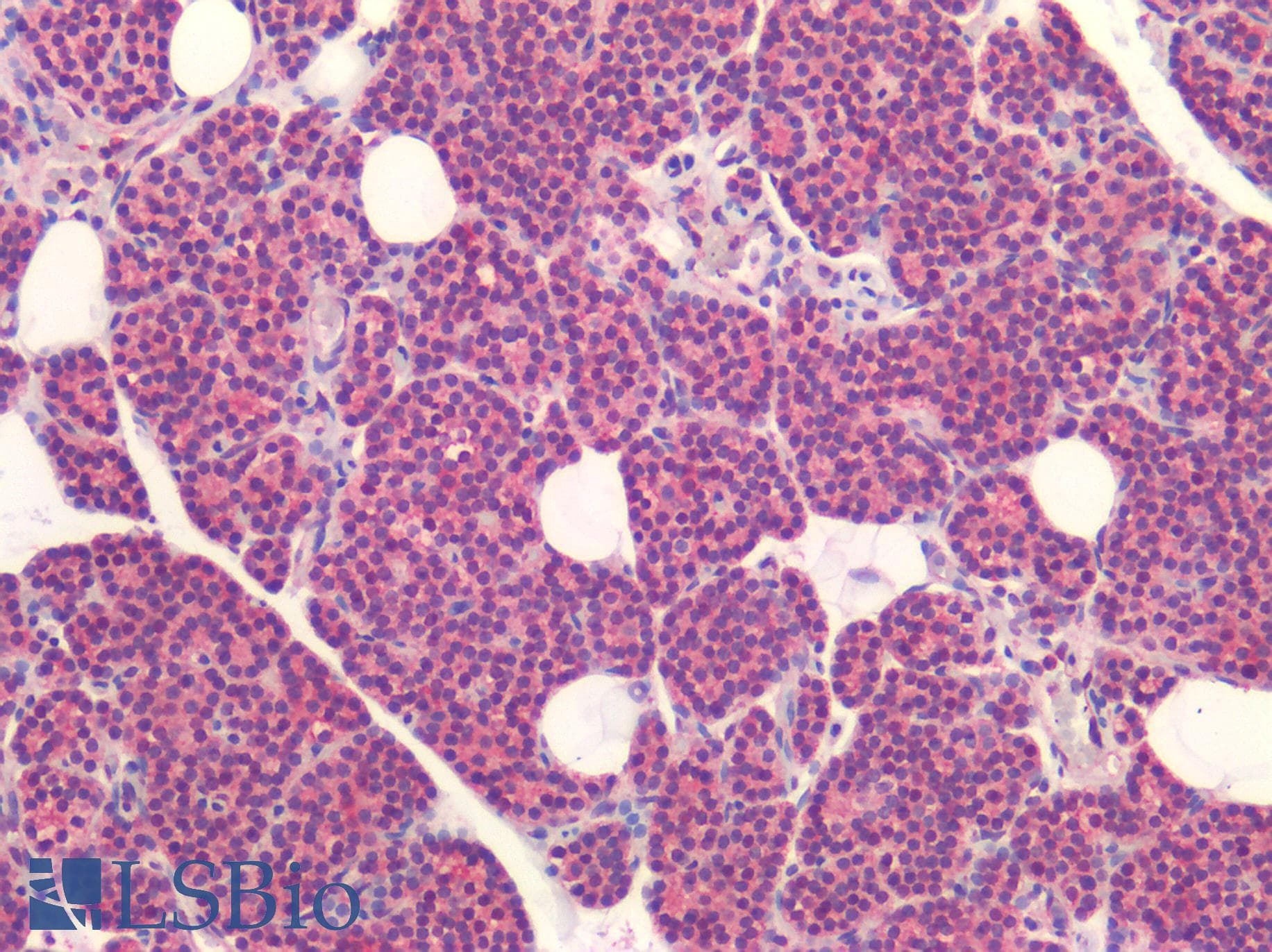 IHC-plus™ Polyclonal Rabbit anti-Human ROR1 Antibody (C-terminal, IHC)