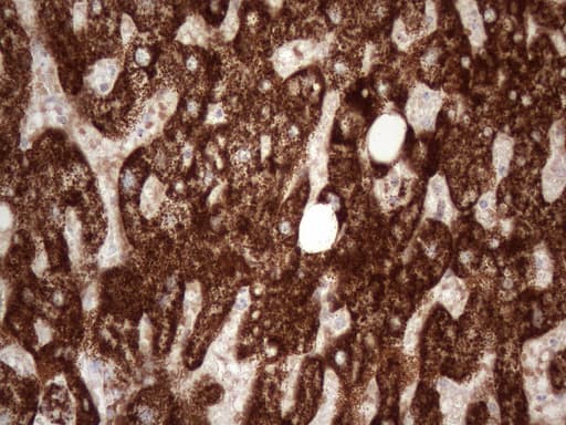 ABAT Antibody (aa29-323, clone UMAB180)