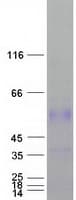 Human PLAT / TPA Protein (Recombinant Myc-DDK (Flag))
