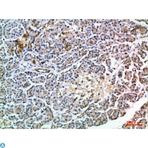 Polyclonal Rabbit anti-Human MIA2 Antibody (WB)