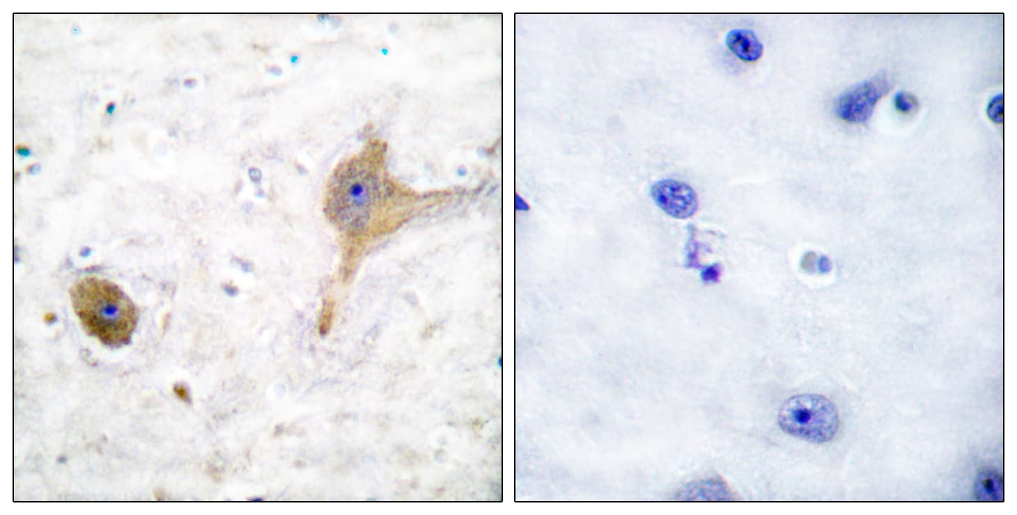 Polyclonal Rabbit anti-Human GABBR1 / GABA B Receptor 1 Antibody (aa871-920, IHC, WB)