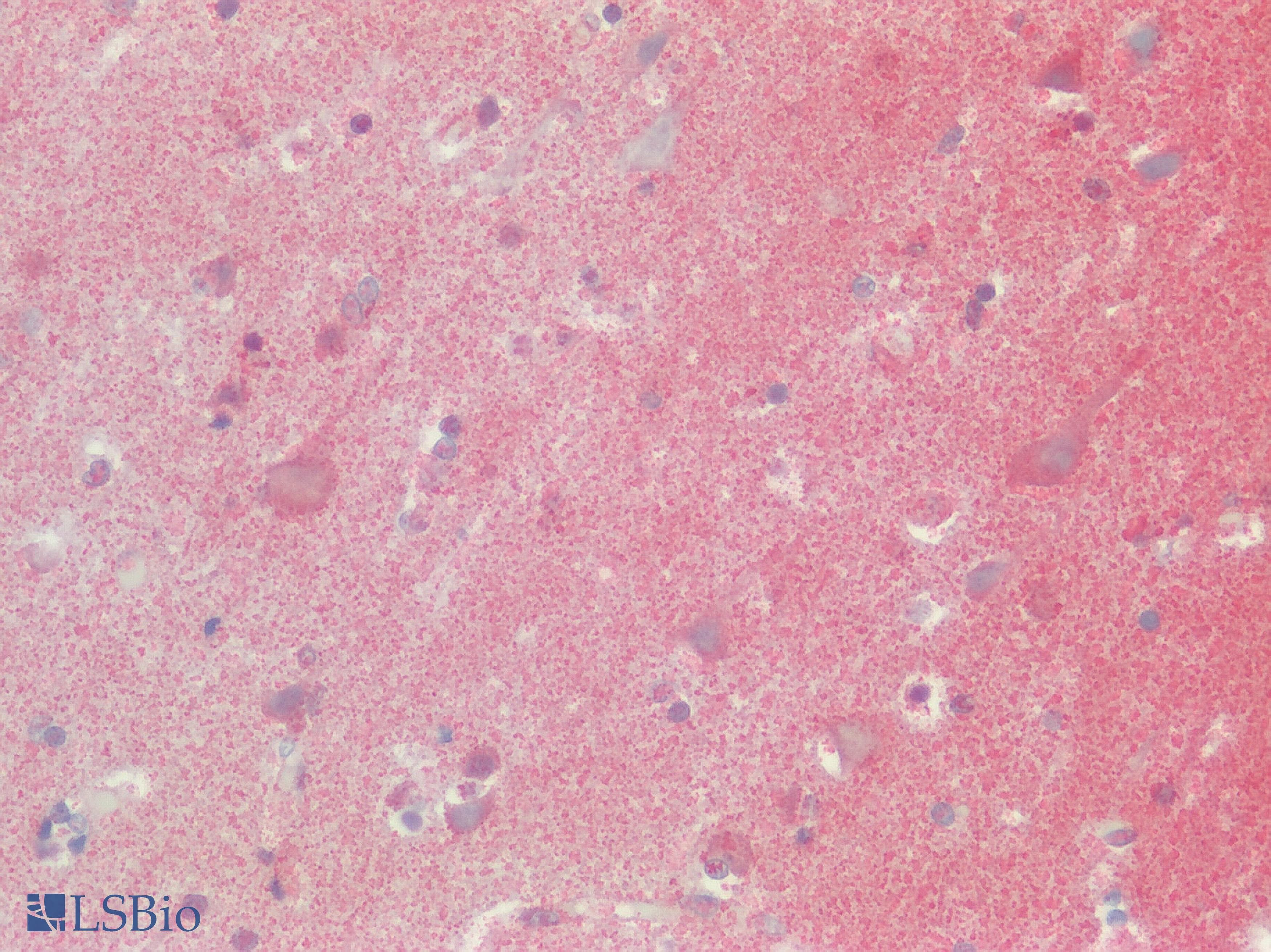IHC-plus™ SSTR2 Antibody (Extracellular Domain)