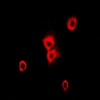 Polyclonal Rabbit anti-Human TUBA4A / TUBA1 Antibody (IHC, IF, WB)