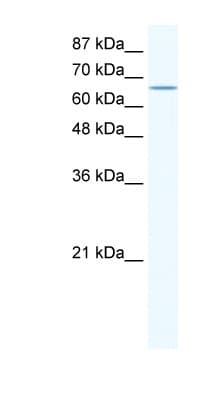 CACNB2 Antibody (N-Terminus)