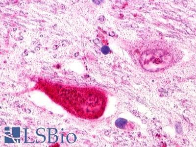 PathPlus™ RXFP1/ LGR7 Antibody (C-Terminus)