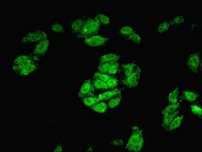Polyclonal Rabbit anti-Human CREB3L2 / BBF2H7 Antibody (aa1-247, IHC, WB)