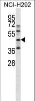 EKLF / KLF1 Antibody (aa248-276)