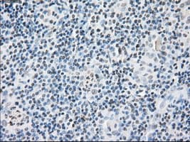 FKBP5 / FKBP51 Antibody (clone OTI3E9)