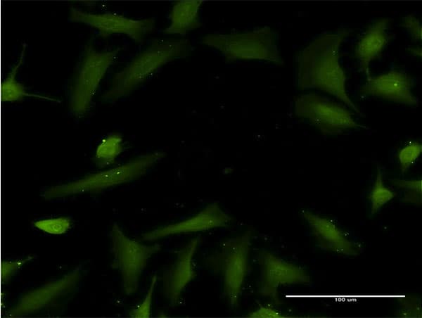 Monoclonal Mouse anti-Human Histatin 3 / HTN3 Antibody (clone 4G9, IF)