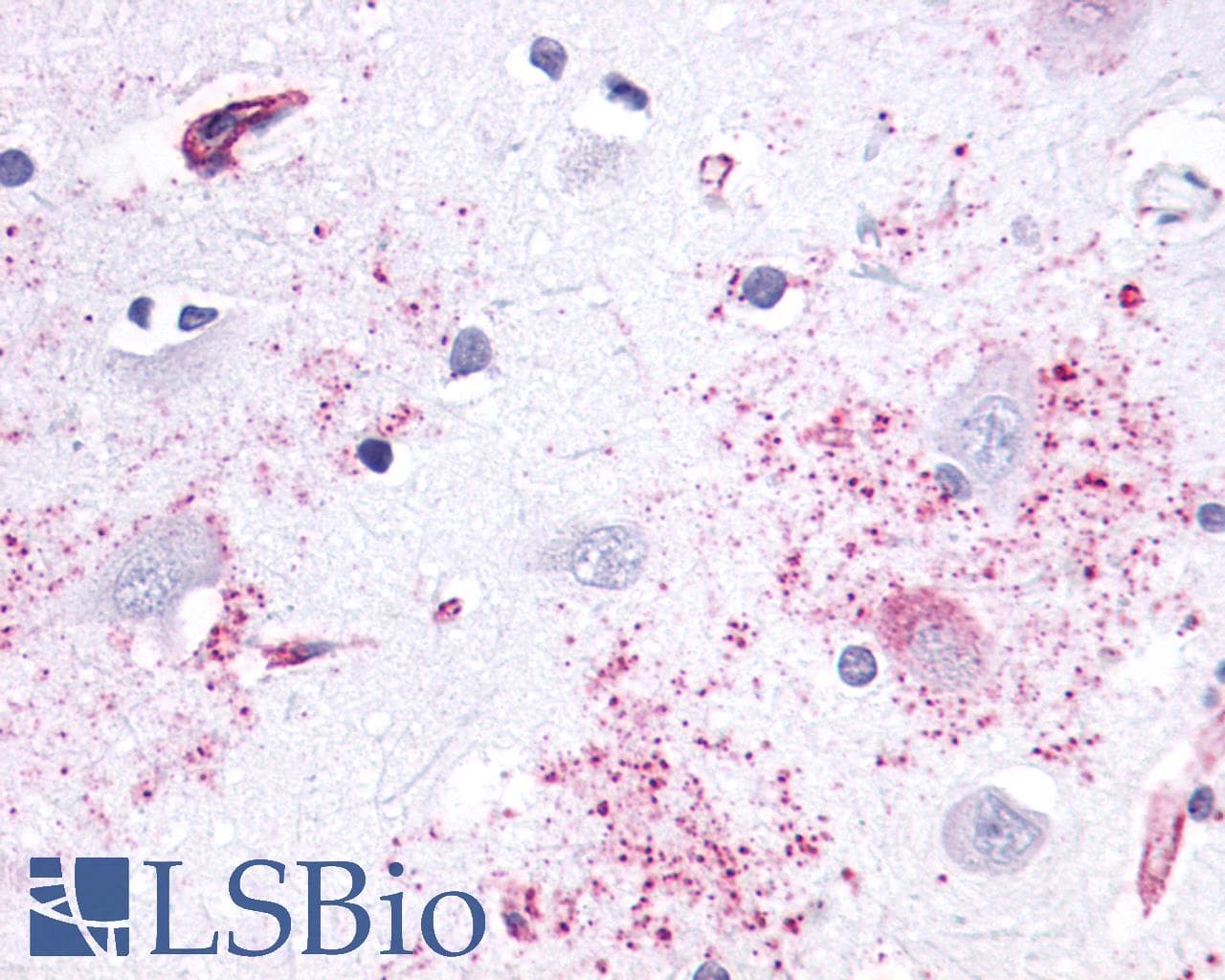 PathPlus™ APLNR/ Apelin Receptor / APJ Antibody (Cytoplasmic Domain)