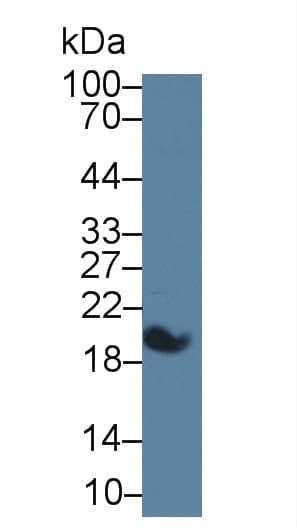 SAA1 / SAA / Serum Amyloid A Antibody