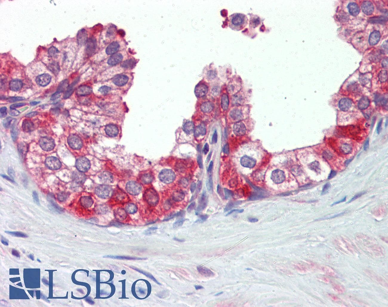 IHC-plus™ Polyclonal Rabbit anti-Human HSP90 / Heat Shock Protein 90 Antibody (aa250-325, IHC, WB)