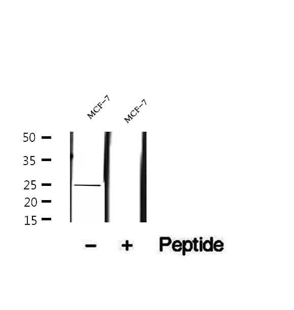 Polyclonal Rabbit anti-Human UQCRFS1 Antibody (IHC, IF, WB)
