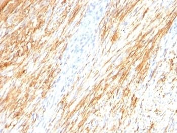 GFAP Antibody (clone ASTRO/789, Ready-to-Use)