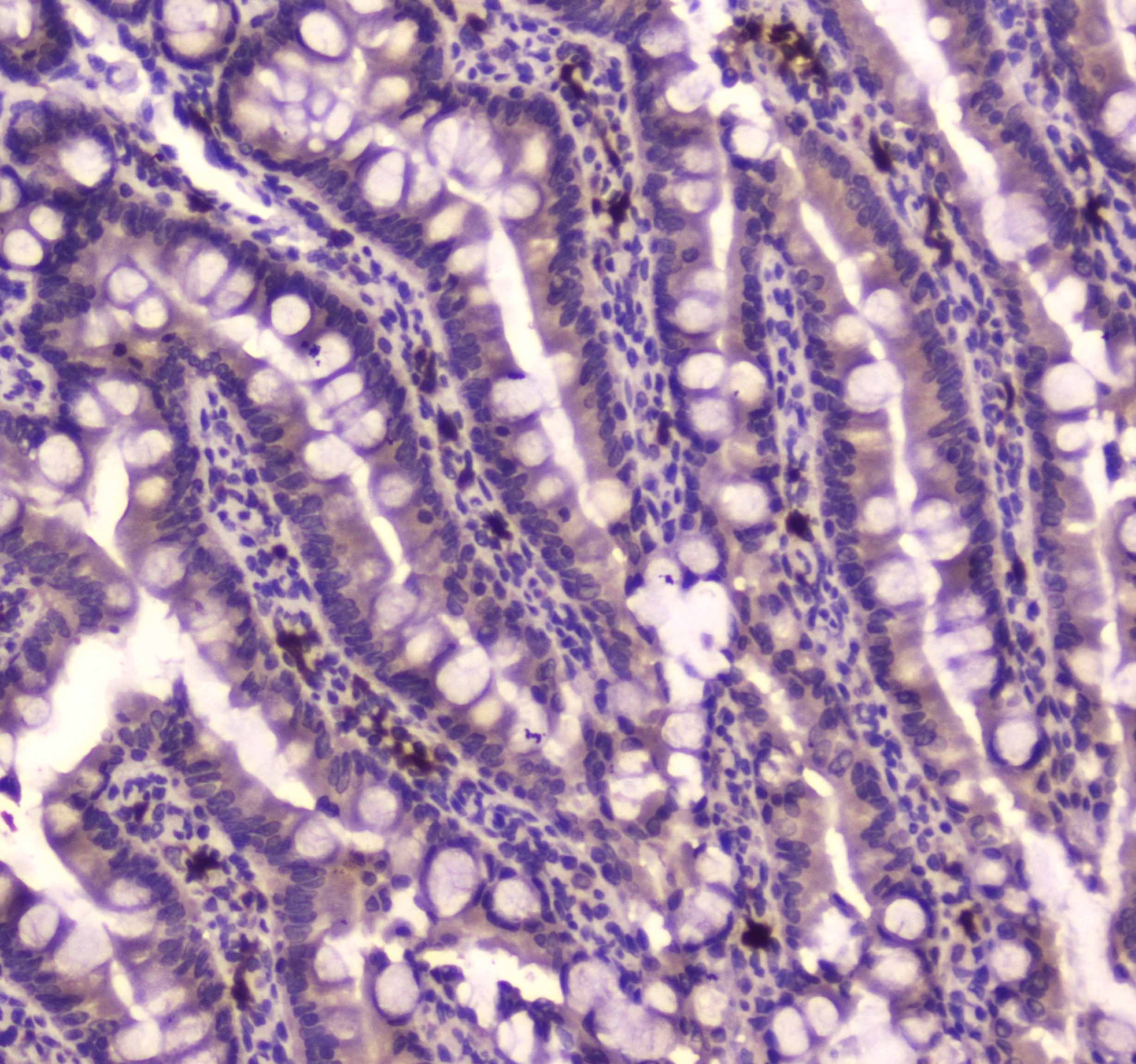 IGF2R / CD222 Antibody