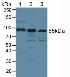 LRP1 / CD91 Antibody (aa4441-4544)