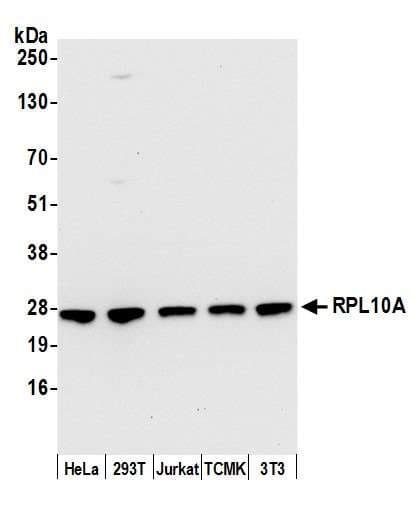 RPL10A Antibody (aa50-100)