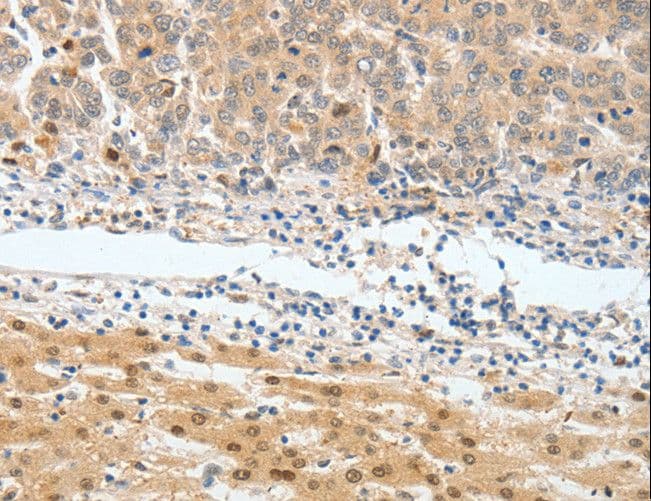 BPIFB2 Antibody