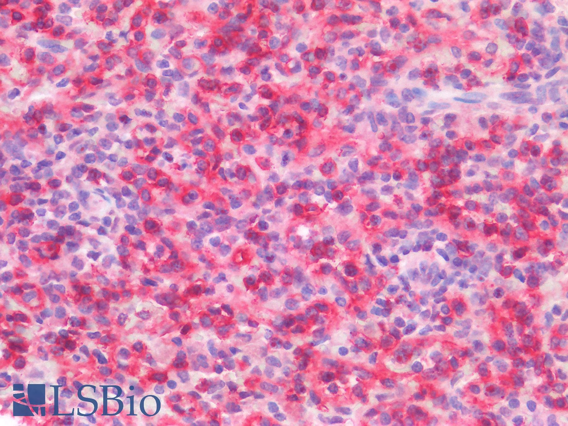 IHC-plus™ CD8A / CD8 Alpha Antibody (clone OTI3H6)