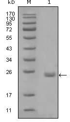 Monoclonal Mouse anti-Human AXL Antibody (clone 1B3A2, WB)
